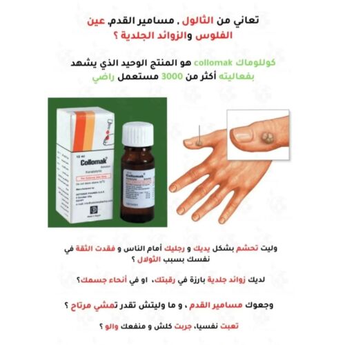 Solution Collomak Topical 10 ML