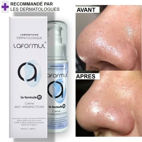 Creme La Formul Anti-imperfection À L'acide Salicylique 50 ML