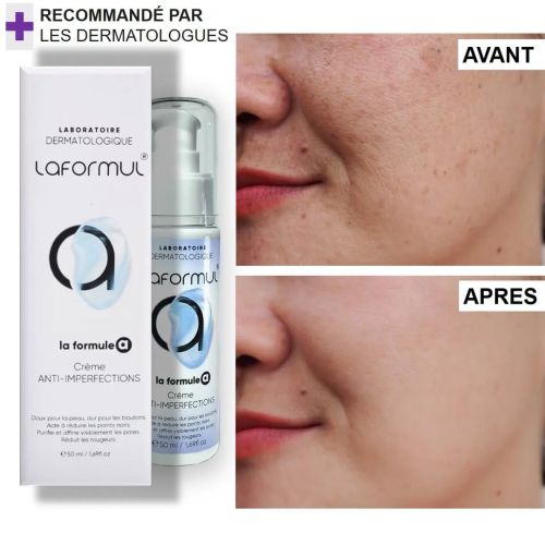 Creme La Formul Anti-imperfection À L'acide Salicylique 50 ML
