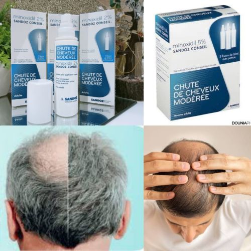 Flacon Minoxidil 2% Sandoz Pulverisateurs 60 ML