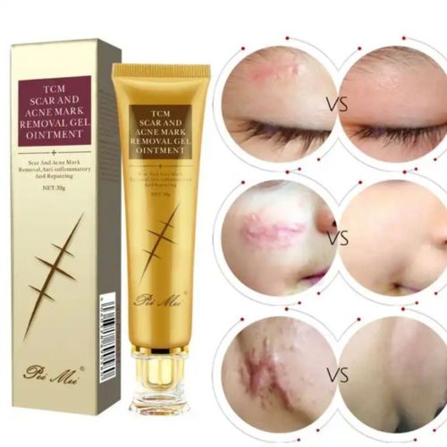 Gel Pei Mei Scar And Mark Removal Gel Ointment 30 G