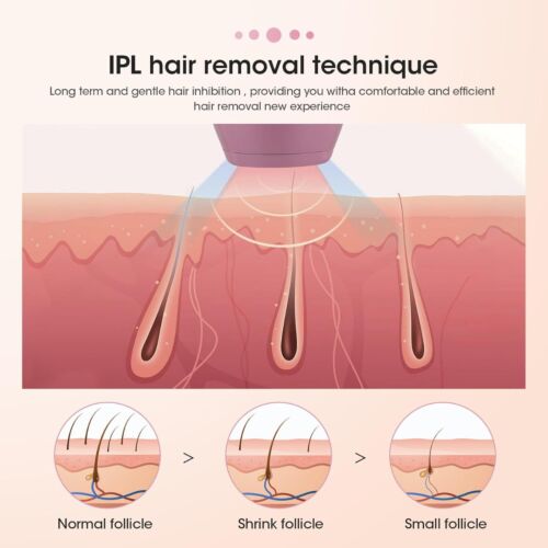 Appareil IPL Épilation Laser