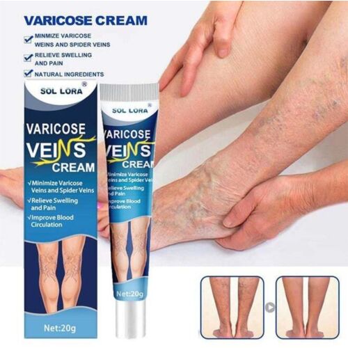 Creme Sol Lora Varicose Veinis Cream 20 G