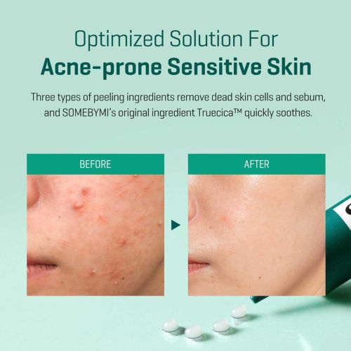 Creme Some Bymi Super Miracle Spot All Kill 30 ML