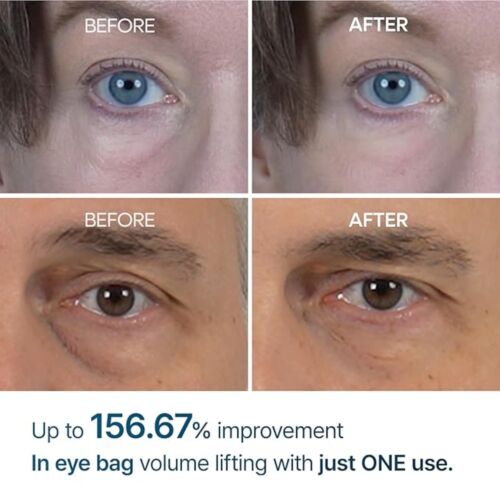 Creme Dr Melaxin Eyephalt Eyecream For Eyebags 10 ML