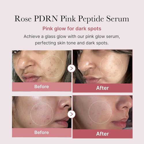 Serum Medicube Pdrn Pink Peptide 30 ML