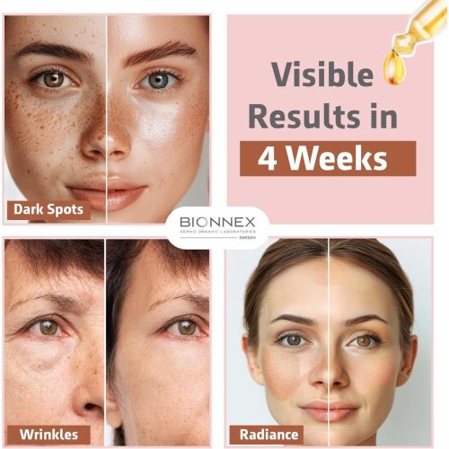 Serum Bionnex The Nordea Cafeine 5% + Angelica 30 ML