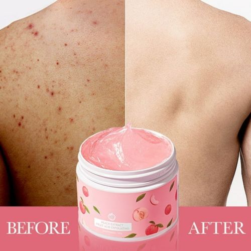 Gommage Bioaqua Extrait De Pêche Acide De Fruit Gel Crème Exfoliant Visage 140 G