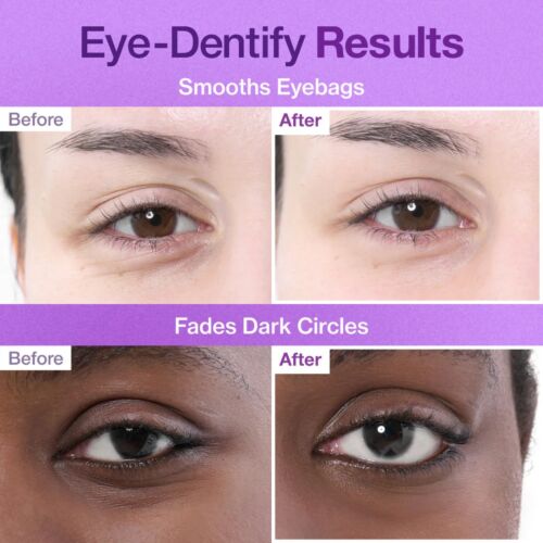 Patches Numbuzin Under Eye Nad+ Collagen + 50 Peptides 9+ 8 G