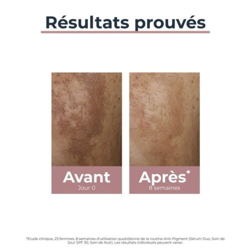 Serum Eucerin Anti-pigment Duo 30 ML