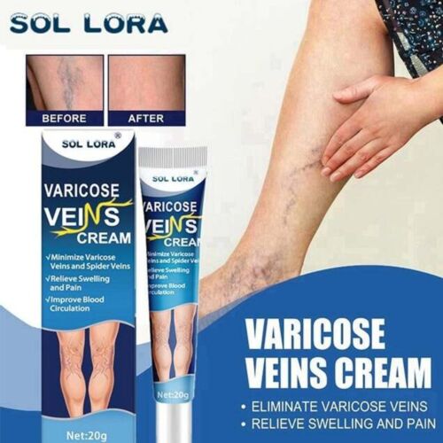 Creme Sol Lora Varicose Veinis Cream 20 G