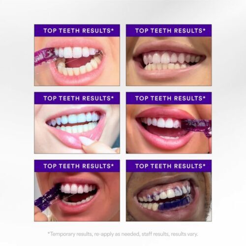 Patches Hismile Blanchiment Dents 30 Mn Application