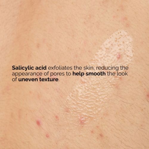 Serum The Ordinary Salicylic Acid 0.5% Body 240 ML