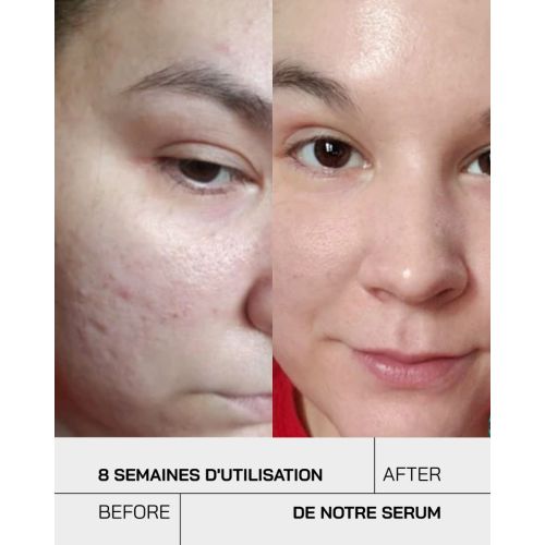 Serum Touche Niacinamide 12%  30 ML