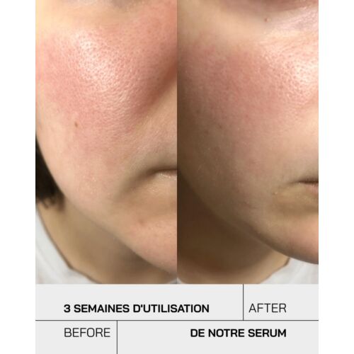 Serum Touche Niacinamide 12%  30 ML
