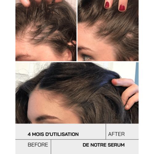 Serum Touche Anti-chute 50 ML