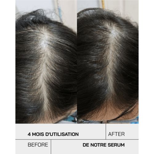 Serum Touche Anti-chute 50 ML