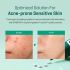 Creme Some Bymi Super Miracle Spot All Kill 30 ML