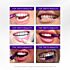 Patches Hismile Blanchiment Dents 30 Mn Application