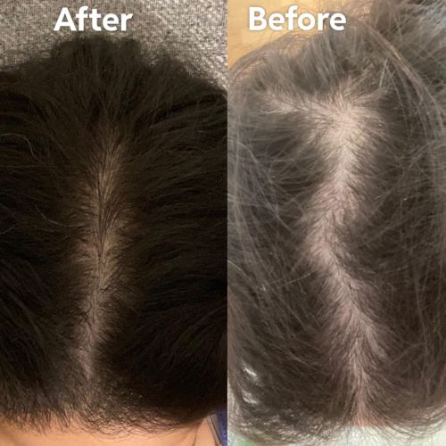 Flacon Minoxidil 2% Sandoz Pulverisateurs 60 ML